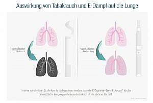 Infografik Vergleich der Wirkung von Rauch und Dampf auf Lungengewebe